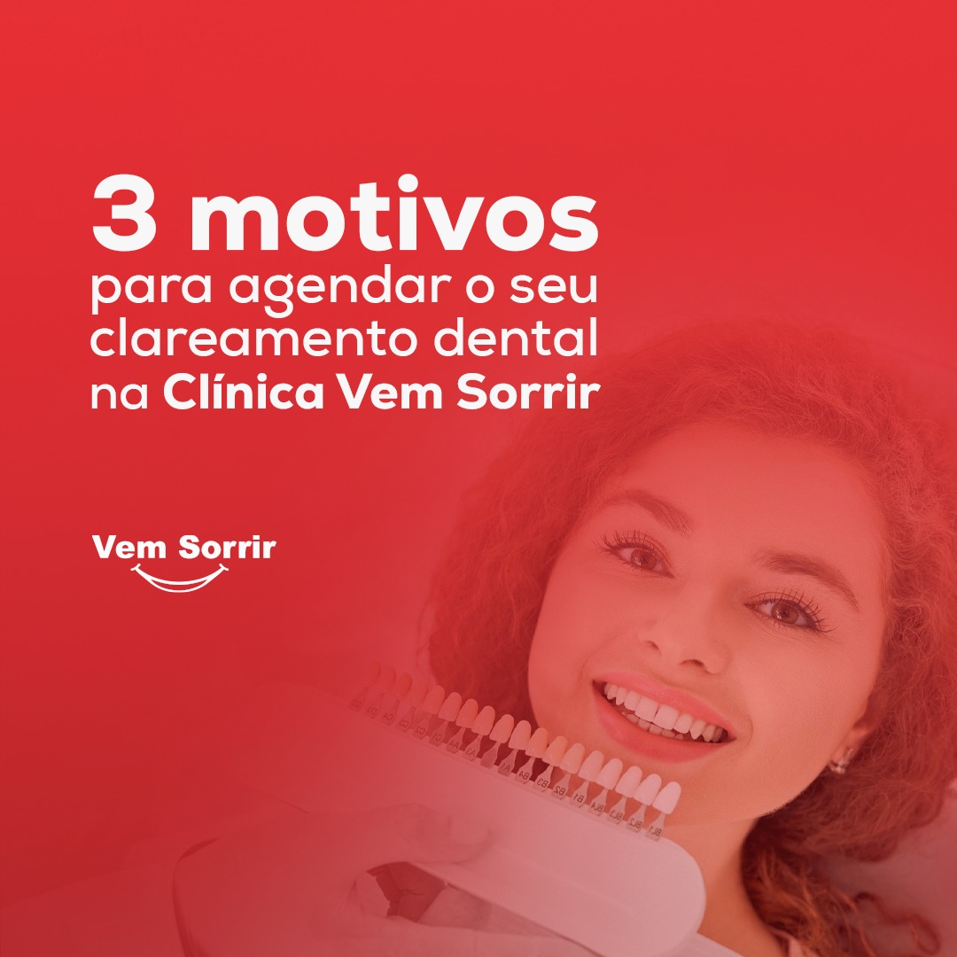 Clareamento dental 2
