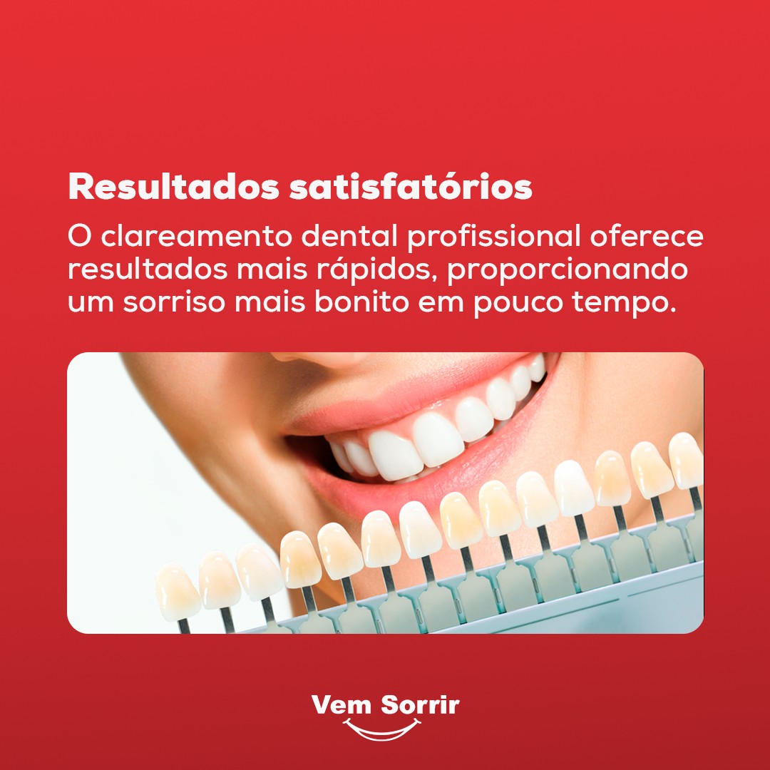 Clareamento dental 4