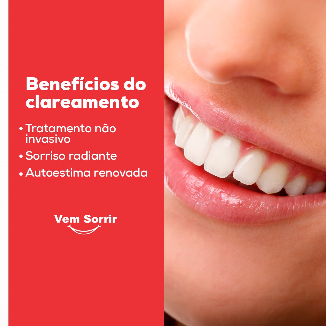 clareamento dental 1